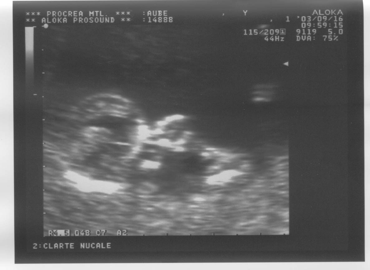 12week_ultrasound_Pic4.jpg, 16/09/2003, 73 kB