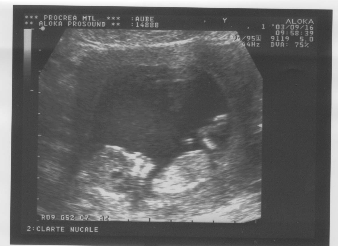 12week_ultrasound_Pic6.jpg, 16/09/2003, 85 kB