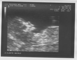 12week_ultrasound_Pic3.jpg