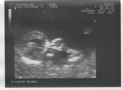 12week_ultrasound_Pic4.jpg