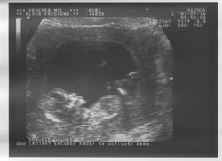 12week_ultrasound_Pic5.jpg