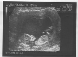 12week_ultrasound_Pic6.jpg